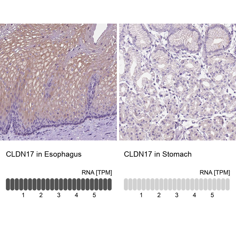 Immunohistochemistry analysis in human esophagus and stomach tissues using Anti-CLDN17 antibody. Corresponding CLDN17 RNA-seq data are presented for the same tissues.