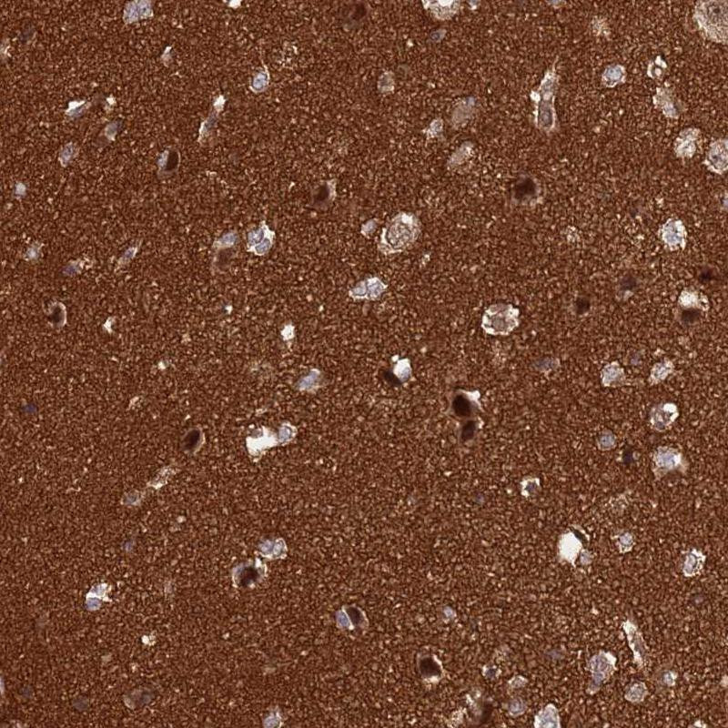 Immunohistochemical staining of human cerebral cortex shows strong positivity in neuropil.