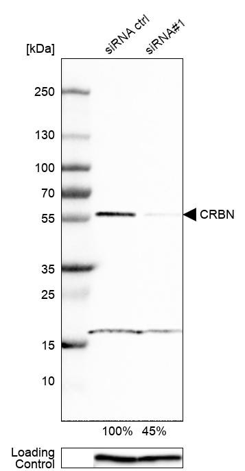Western blot analysis in HEK293 cells transfected with control siRNA, target specific siRNA probe #1, using Anti-CRBN antibody. Remaining relative intensity is presented. Loading control: Anti-GAPDH.