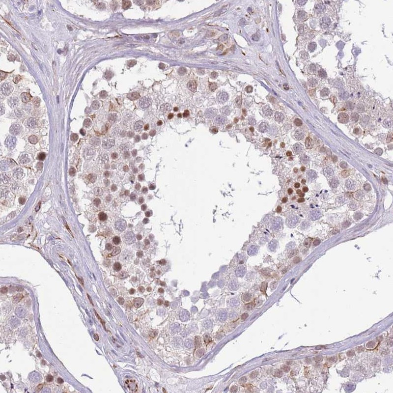 Immunohistochemical staining of human testis shows moderate nuclear positivity in cells of seminiferus ducts.