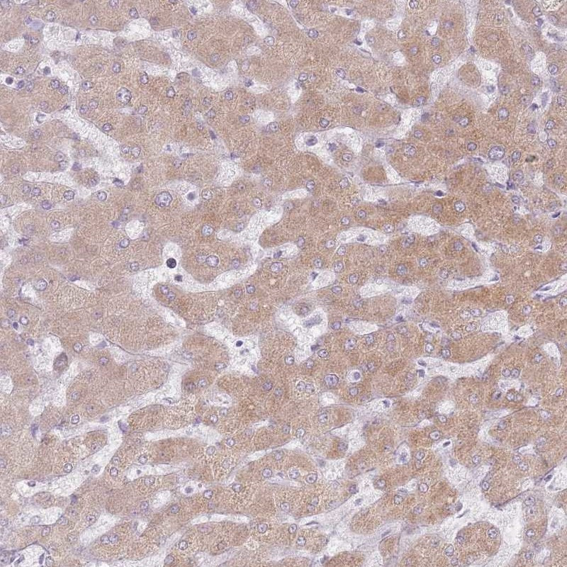 Immunohistochemical staining of human liver shows moderate cytoplasmic positivity in hepatoctytes.