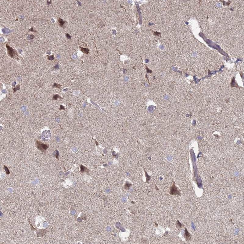 Immunohistochemical staining of human cerebral cortex shows moderate cytoplasmic positivity in neuronal cells.