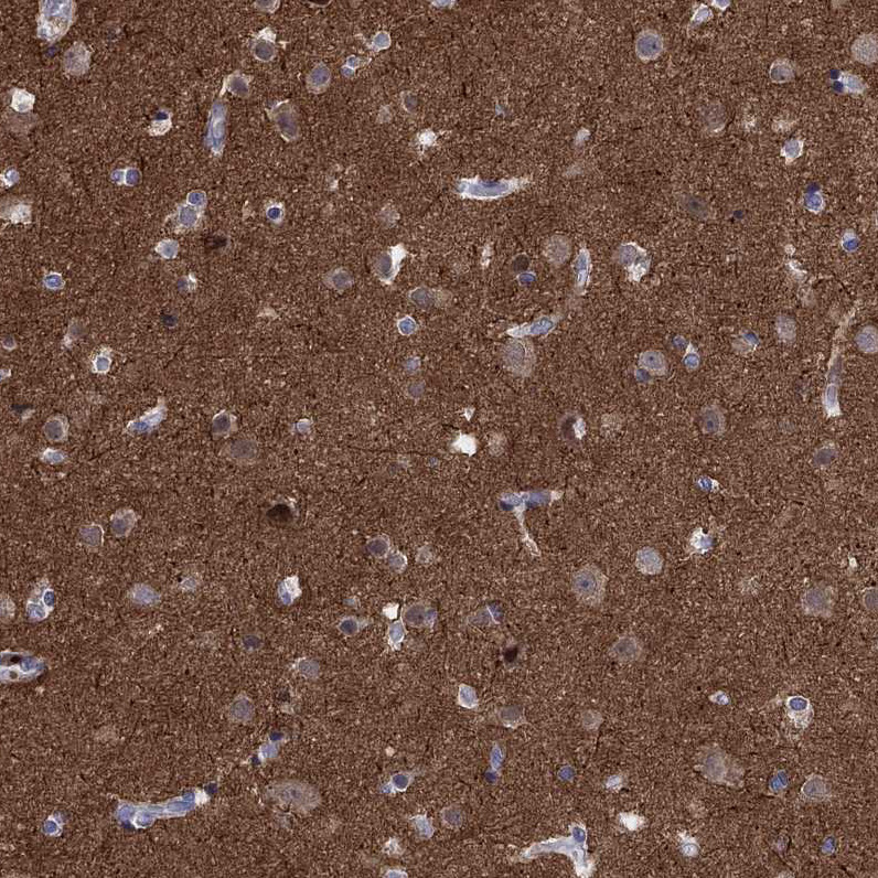 Immunohistochemical staining of human cerebral cortex shows strong cytoplasmic positivity in neuropil.