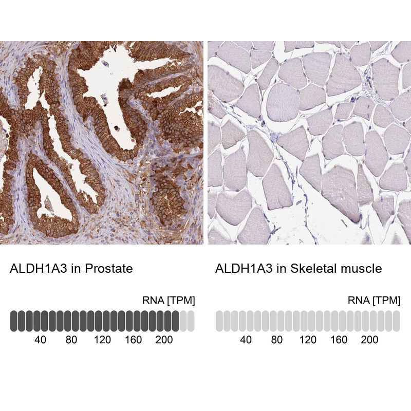 Immunohistochemistry analysis in human prostate and skeletal muscle tissues using HPA046271 antibody. Corresponding ALDH1A3 RNA-seq data are presented for the same tissues.
