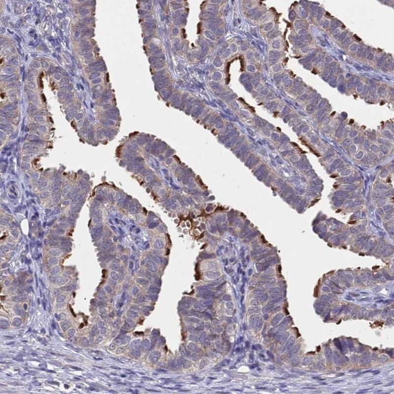 Immunohistochemical staining of human fallopian tube shows strong positivity in cilia.