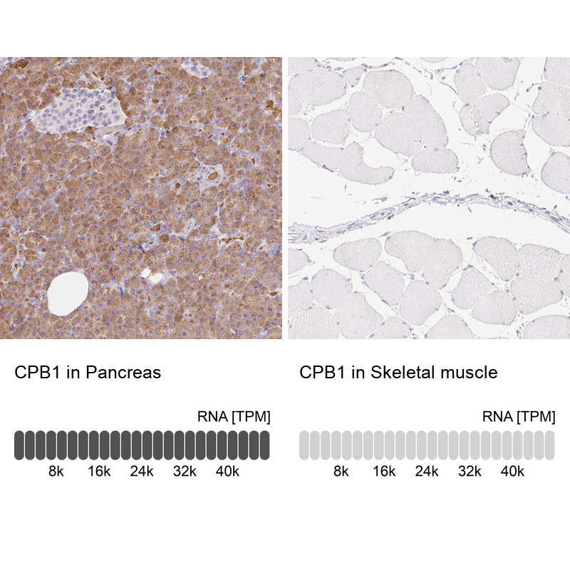 Immunohistochemistry analysis in human pancreas and skeletal muscle tissues using Anti-CPB1 antibody. Corresponding CPB1 RNA-seq data are presented for the same tissues.