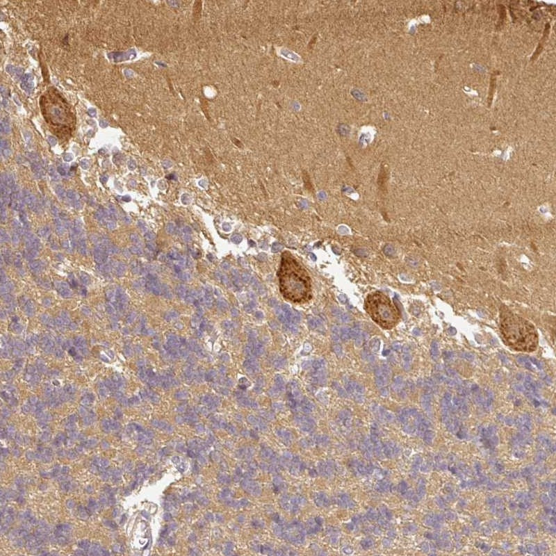 Immunohistochemical staining of human cerebellum shows strong cytoplasmic positivity in Purkinje cells.