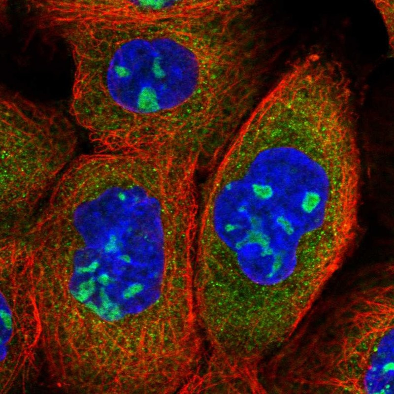 Immunofluorescent staining of human cell line A-431 shows localization to nucleoli & cytosol.
