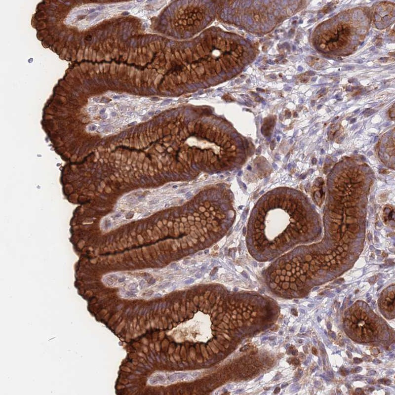 Immunohistochemical staining of human stomach, upper shows strong cytoplasmic and membranous positivity in glandular cells.