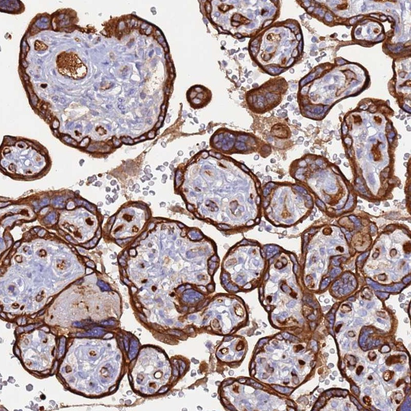 Immunohistochemical staining of human placenta shows cytoplasmic and membranous positivity in trophoblastic cells.