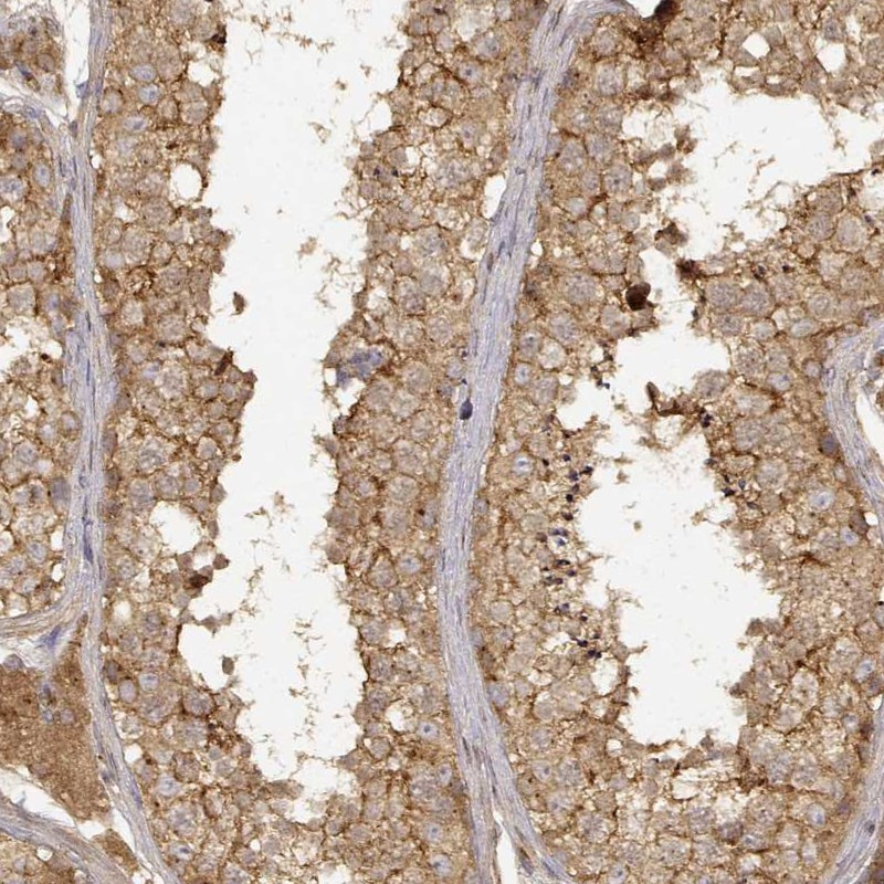 Immunohistochemical staining of human testis shows moderate cytoplasmic positivity in cells in seminiferous ducts and Leydig cells.