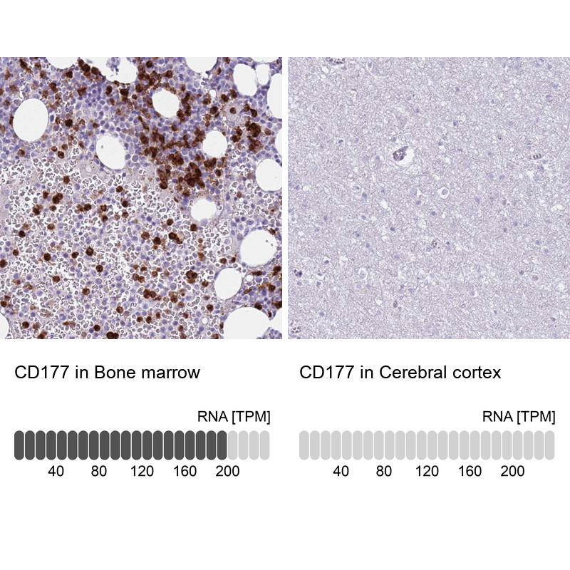 Immunohistochemistry analysis in human bone marrow and cerebral cortex tissues using Anti-CD177 antibody. Corresponding CD177 RNA-seq data are presented for the same tissues.