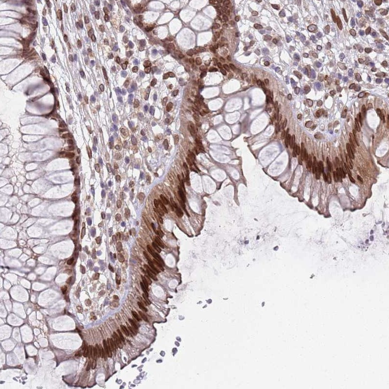 Immunohistochemical staining of human rectum shows strong nuclear membrane positivity in glandular cells.