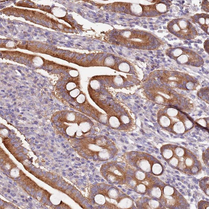 Immunohistochemical staining of human duodenum shows strong cytoplasmic positivity in glandular cells.