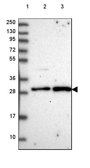 Lane 1: Marker [kDa] 250, 130, 95, 72, 55, 36, 28, 17, 10<br/>Lane 2: Human cell line RT-4<br/>Lane 3: Human cell line U-251 MG