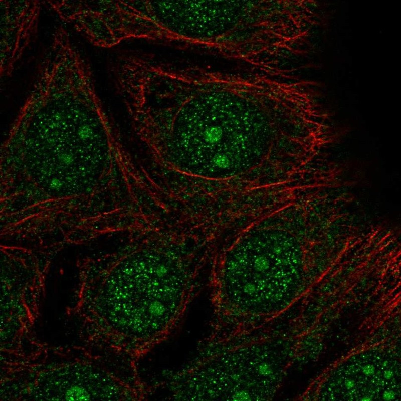 Immunofluorescent staining of human cell line MCF7 shows localization to nucleus & nucleoli.