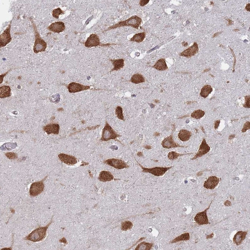 Immunohistochemical staining of human hippocampus shows strong cytoplasmic positivity in neuronal cells.