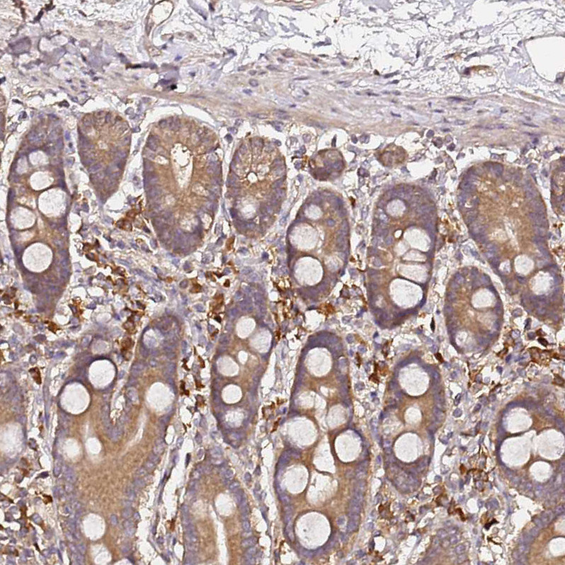 Immunohistochemical staining of human gastrointestinal shows strong cytoplasmic positivity in glandular cells.