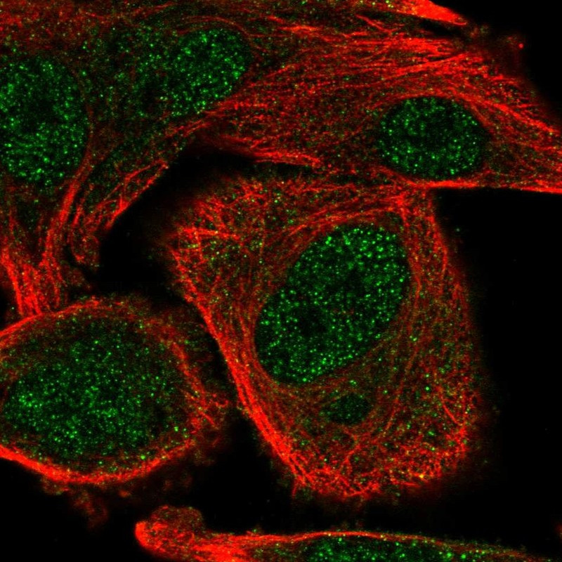 Immunofluorescent staining of human cell line PC-3 shows localization to nucleoplasm & cytosol.