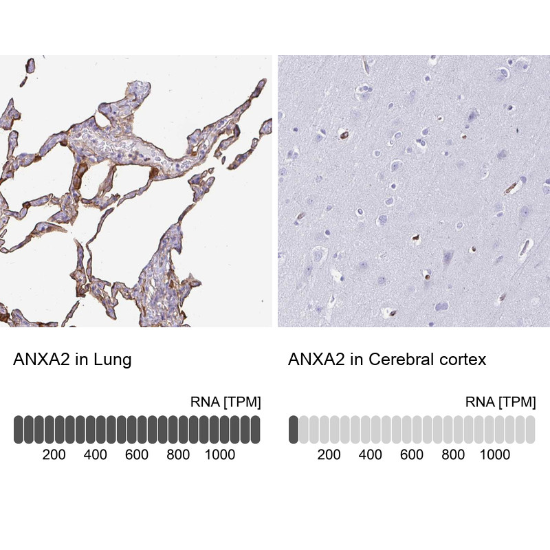 Immunohistochemistry analysis in human lung and cerebral cortex tissues using Anti-ANXA2 antibody. Corresponding ANXA2 RNA-seq data are presented for the same tissues.