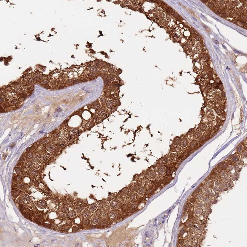 Immunohistochemical staining of human testis shows strong cytoplasmic positivity in cells of seminiferus ducts.