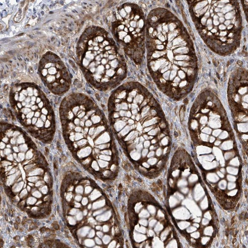 Immunohistochemical staining of human colon shows strong cytoplasmic positivity in glandular cells.