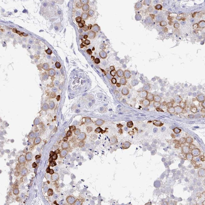 Immunohistochemical staining of human testis shows strong cytoplasmic positivity in cells in seminiferous ducts.