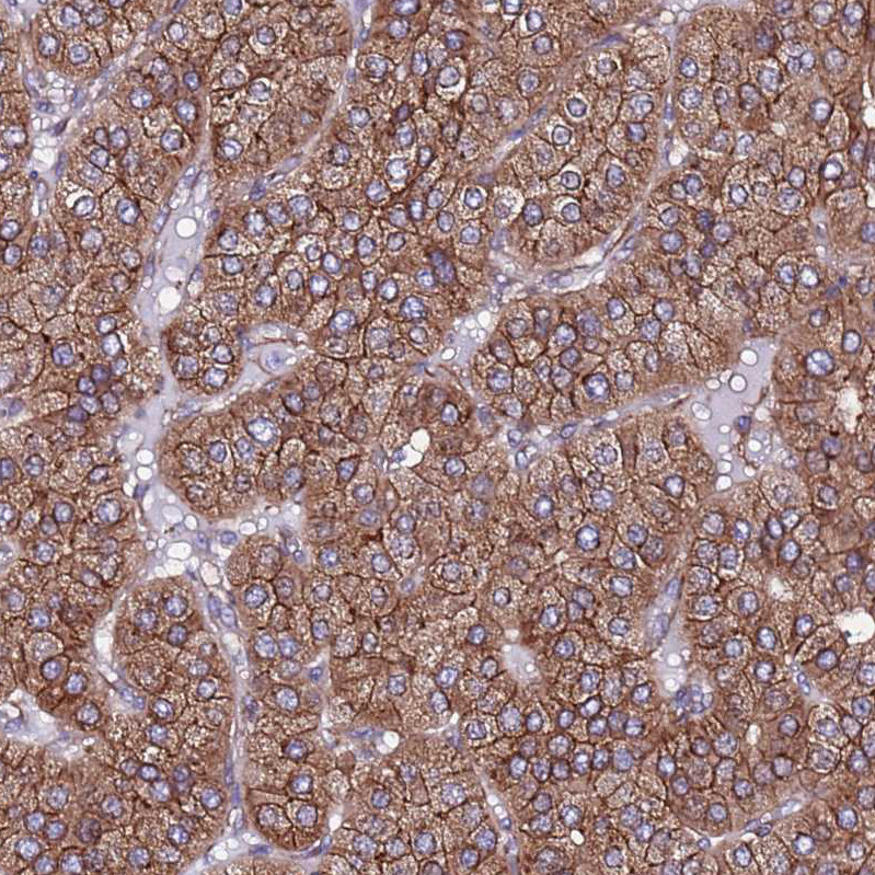 Immunohistochemical staining of human parathyroid gland shows strong cytoplasmic granular positivity in glandular cells.