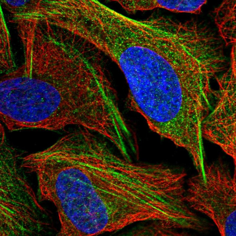 Immunofluorescent staining of human cell line U-2 OS shows positivity in actin filaments.