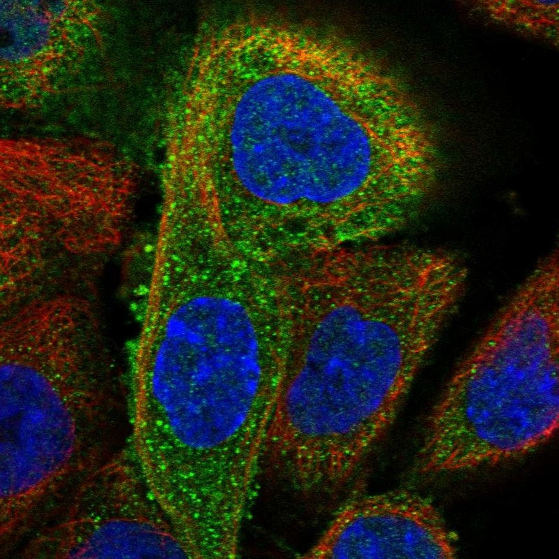 Immunofluorescent staining of human cell line A-431 shows localization to cytosol.