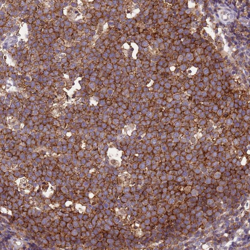Immunohistochemical staining of human tonsil shows strong cytoplasmic positivity in germinal center cells.
