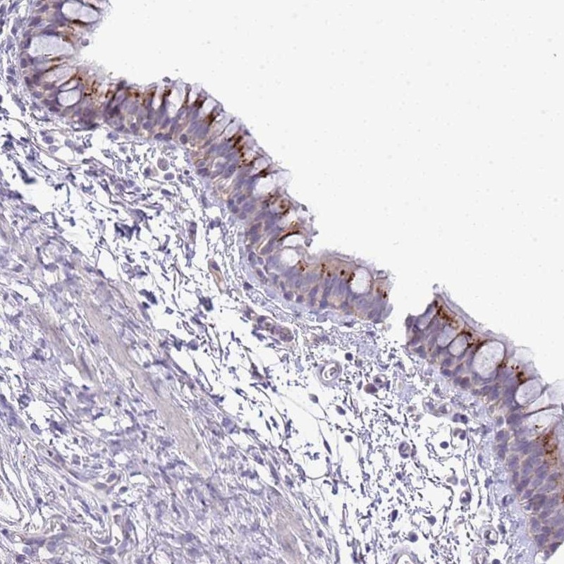 Immunohistochemical staining of human bronchus shows strong cytoplasmic positivity in respiratory epithelial cells.