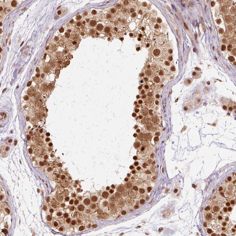 Immunohistochemical staining of human testis shows strong nuclear and cytoplasmic positivity in cells in seminiferus ducts.
