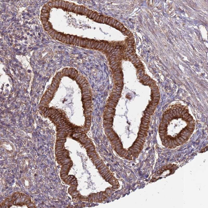 Immunohistochemical staining of human uterus, pre-menopause shows strong cytoplasmic positivity in glandular cells.