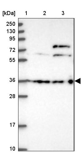 Lane 1: Marker [kDa] 250, 130, 95, 72, 55, 36, 28, 17, 10<br/>Lane 2: Human cell line RT-4<br/>Lane 3: Human cell line U-251MG sp