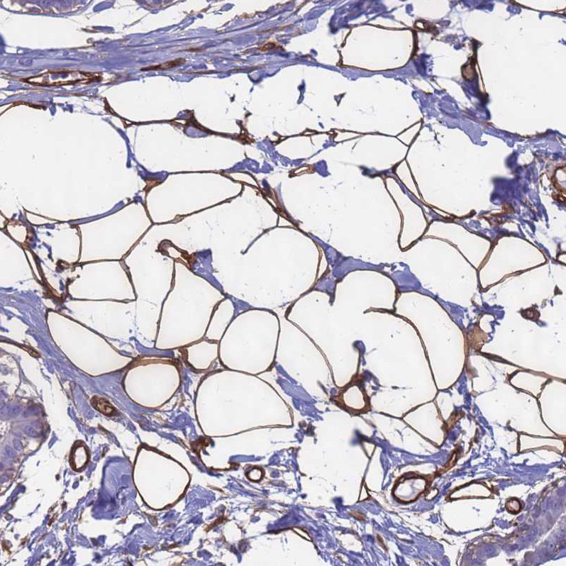 Immunohistochemical staining of human Breast shows strong membranous positivity in adipocytes.
