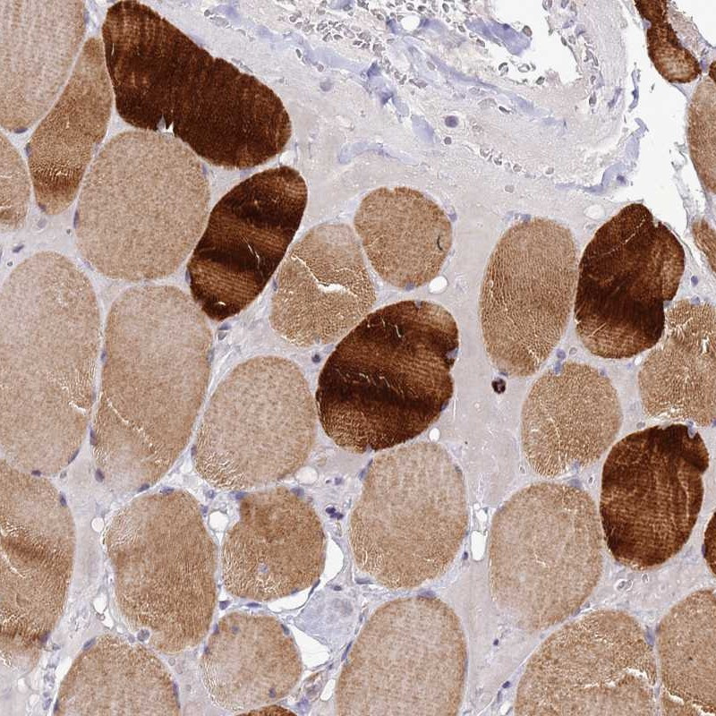 Immunohistochemical staining of human skeletal muscle showed strong cytoplasmic positivity in myocytes.