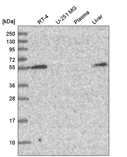 Western blot analysis in human cell line RT-4, human cell line U-251 MG, human plasma and human liver tissue.