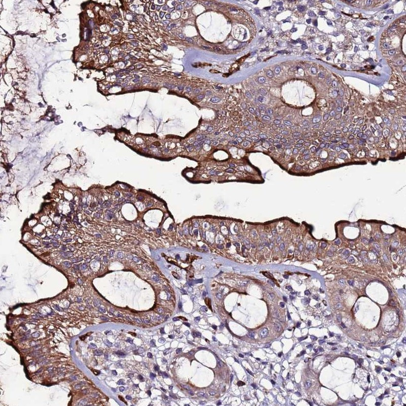 Immunohistochemical staining of human rectum shows distinct membranous and cytoplasmic positivity in glandular cells.