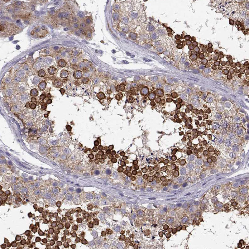 Immunohistochemical staining of human testis shows strong cytoplasmic positivity in cells in seminiferous ducts.