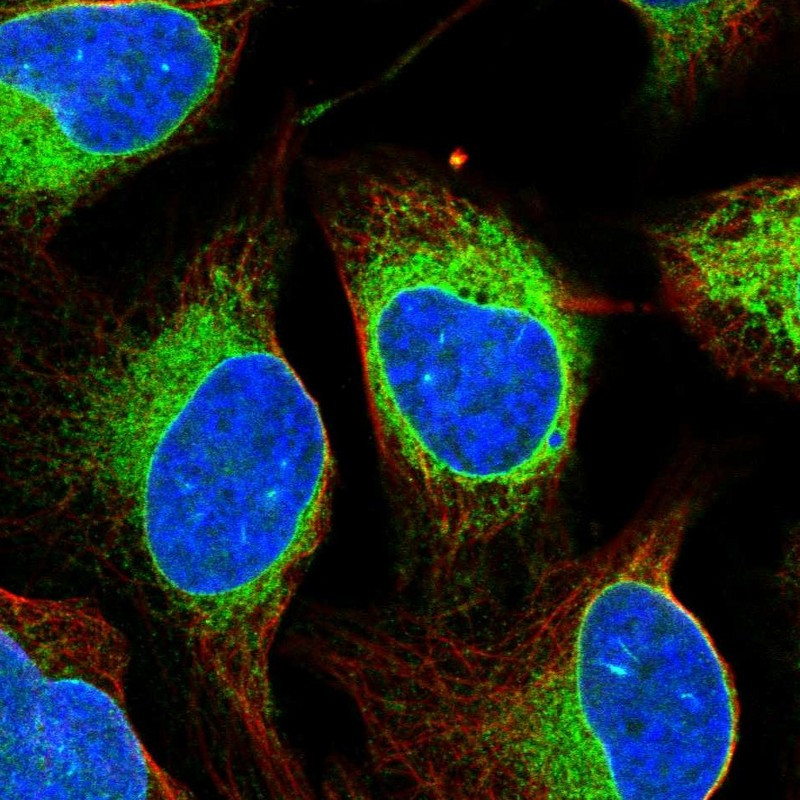 Immunofluorescent staining of human cell line U-2 OS shows localization to endoplasmic reticulum.