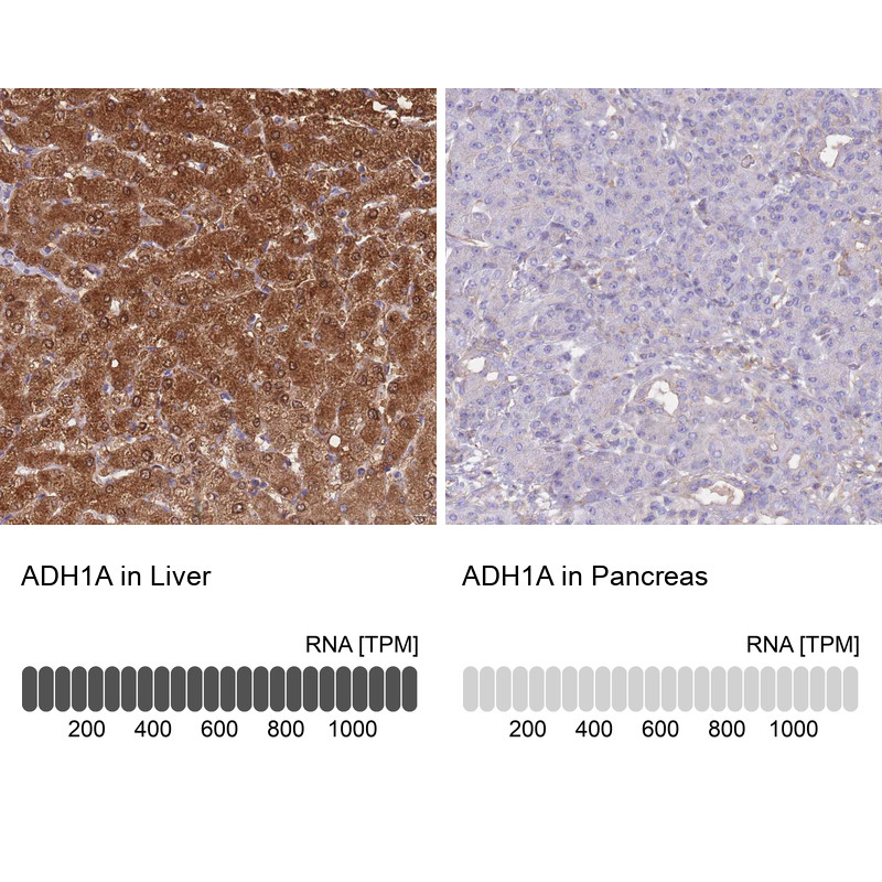 Immunohistochemistry analysis in human liver and pancreas tissues using HPA047814 antibody. Corresponding ADH1A RNA-seq data are presented for the same tissues.