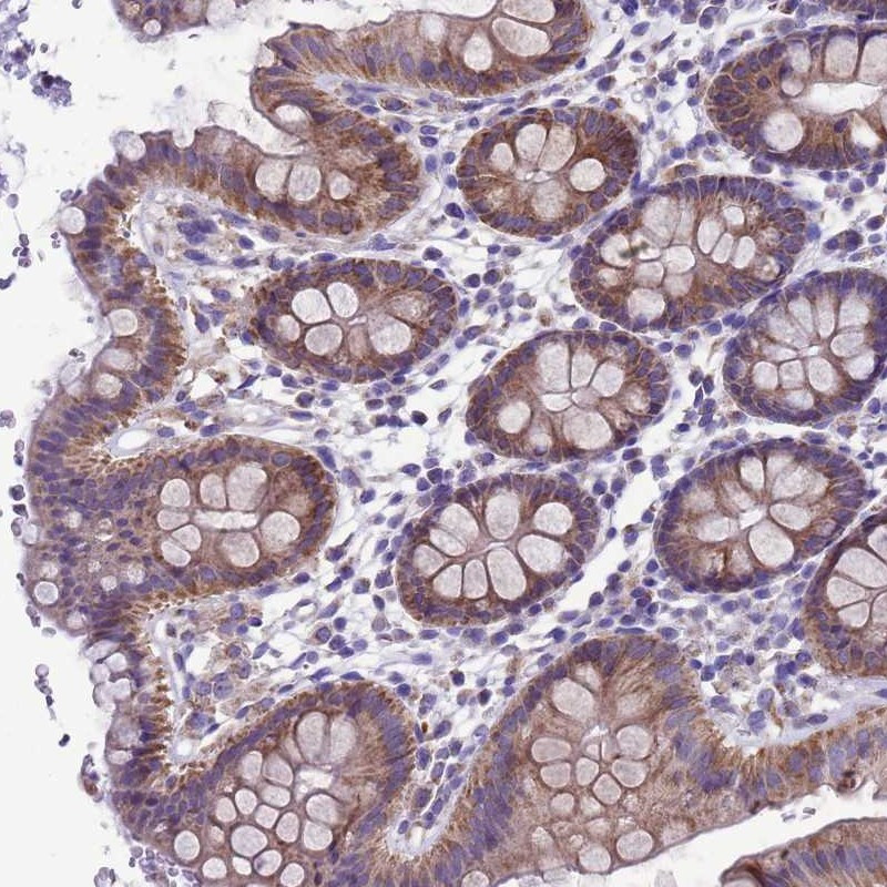 Immunohistochemical staining of human colon shows moderate cytoplasmic positivity in glandular cells.