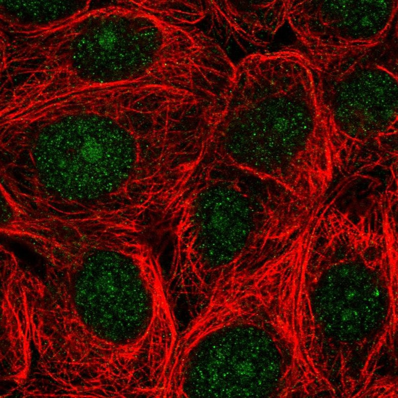 Immunofluorescent staining of human cell line MCF7 shows localization to nucleus & nucleoli.