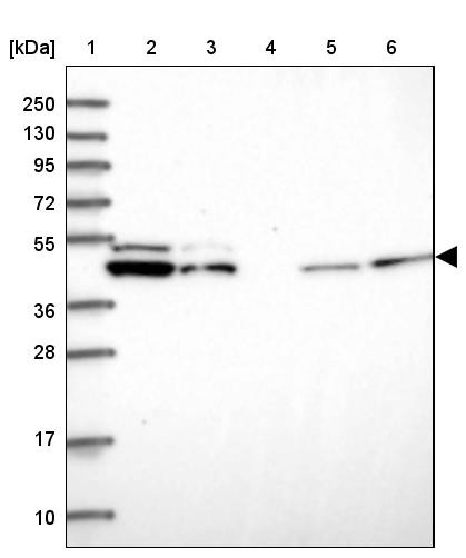Lane 1: Marker [kDa] 250, 130, 95, 72, 55, 36, 28, 17, 10<br/>Lane 2: Human cell line RT-4<br/>Lane 3: Human cell line U-251MG sp<br/>Lane 4: Human plasma (IgG/HSA depleted)<br/>Lane 5: Human liver tissue<br/>Lane 6: Human tonsil tissue