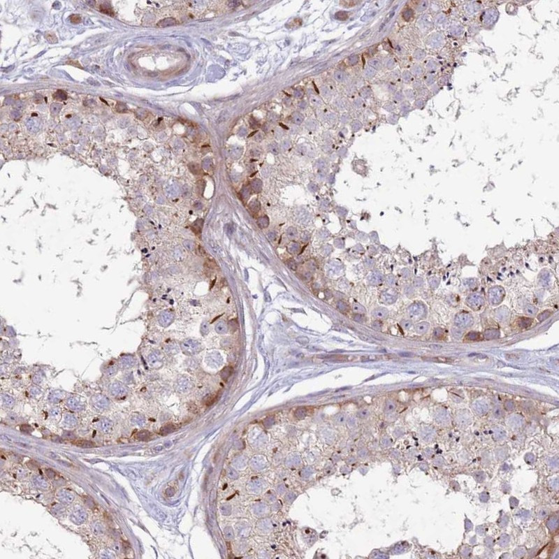 Immunohistochemical staining of human testis shows cytoplasmic positivity in cells of seminiferous ducts.