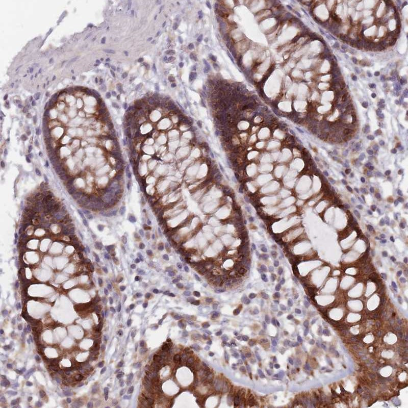Immunohistochemical staining of human colon shows strong cytoplasmic positivity in glandular cells.