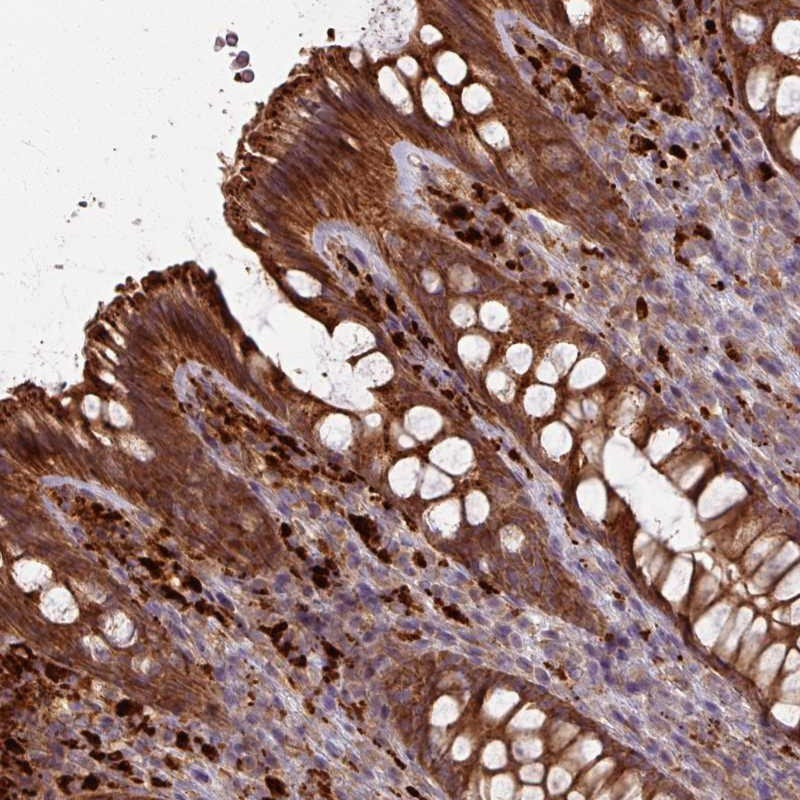 Immunohistochemical staining of human colon shows strong cytoplasmic positivity in glandular cells.