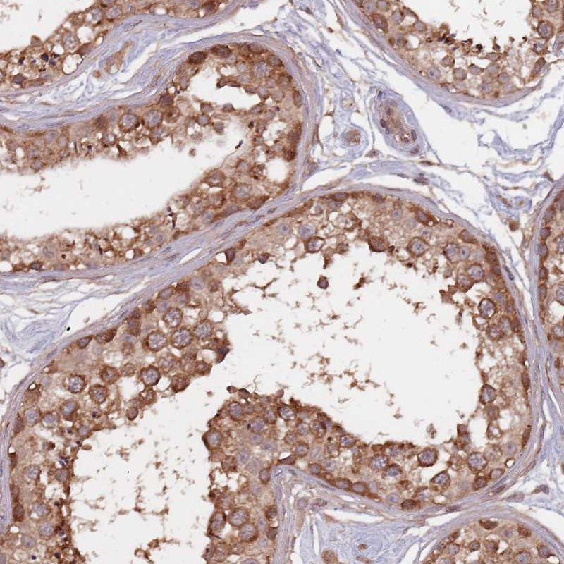 Immunohistochemical staining of human testis shows strong cytoplasmic positivity in cells in seminiferus ducts.
