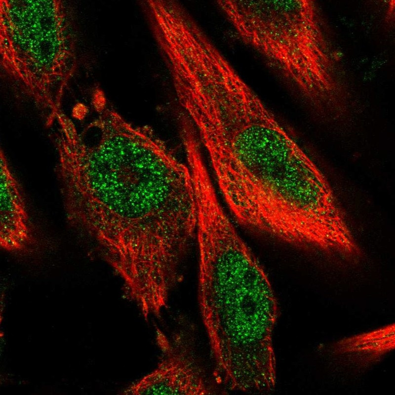 Immunofluorescent staining of human cell line U-251 MG shows localization to nucleoplasm.